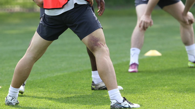 Ouch Pablos battle scars from the FA semi